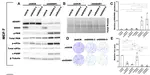 Induction of viral mimicry upon loss of DHX9 and ADAR1 in breast cancer cells